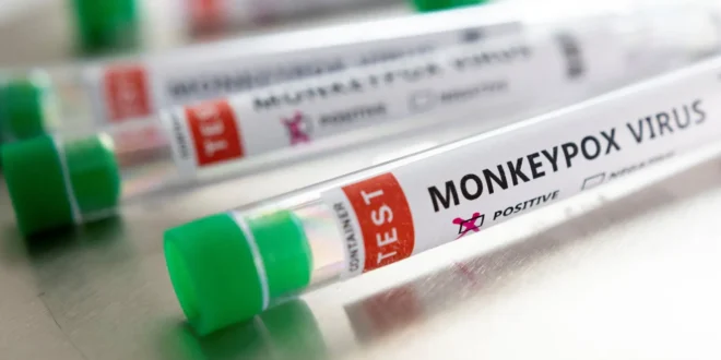 WHO declares highest alert over outbreak of monkeypox
