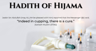 Hijamah (Cupping)